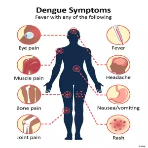 Dengue Symptoms